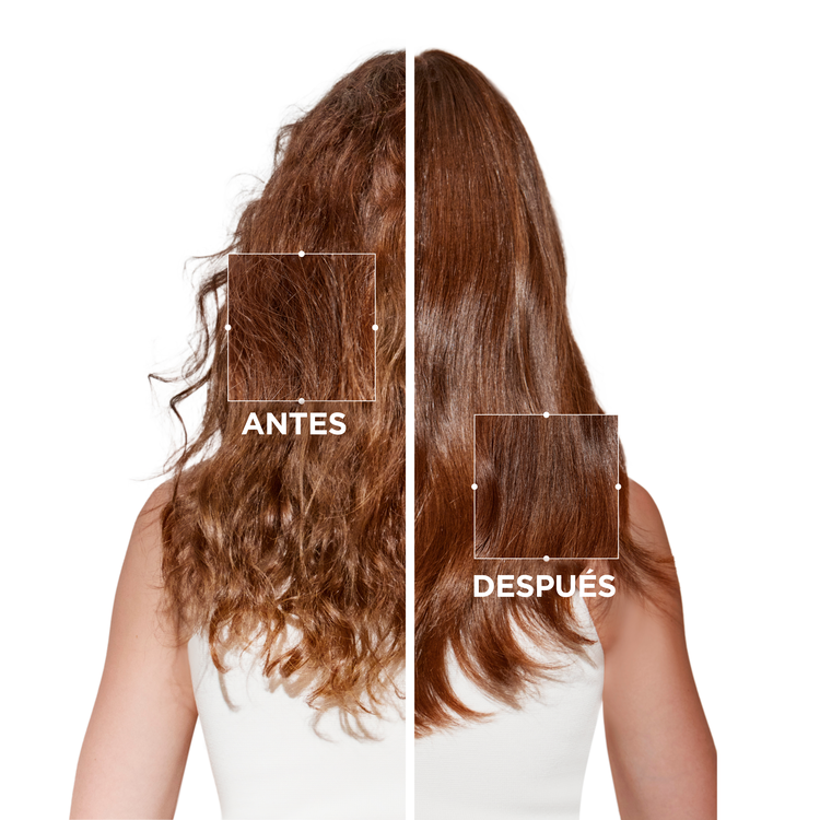 Symbiose antes y despues para combatir la caspa en el cuero cabelludo graso - Atras
